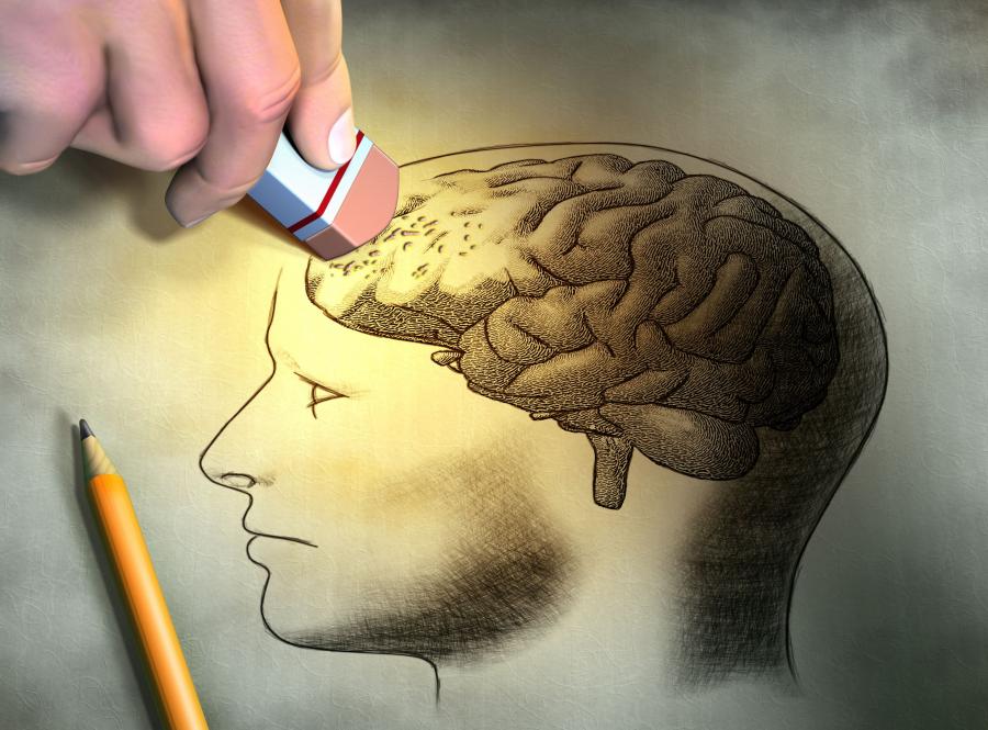 Mity na temat alzheimera