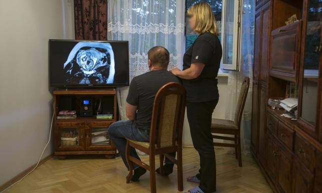 Agnieszka i Jacek, rodzice dziecka, którym prof. Chazan odmówił aborcji