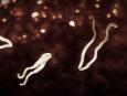 Trypanosoma brucei rhodesiense, czyli świdrowiec rodezyjski – ten śmiertelnie groźny pasożyt jest przenoszony przez muchę tse-tse. Nieleczona infekcja w kilka miesięcy prowadzi  do śmierci